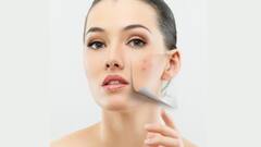 বয়স যাই হোক, ত্বকের বয়স বাড়বে না যা করলে