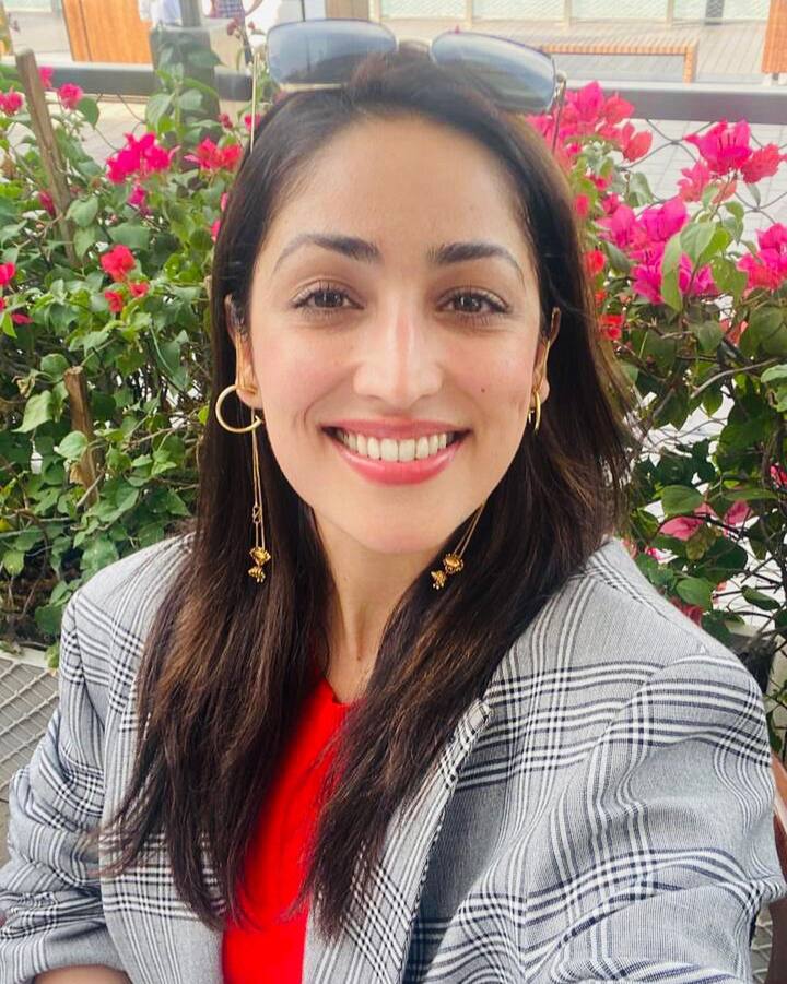 हा त्वचेच्या संबंधीत आजार आहे. यामध्ये चेहऱ्यावर लहान पिंपल्स येतात. आता बऱ्याच वर्षांपासून मी याचा सामना केला आणि आज शेवटी, मी भीती आणि असुरक्षितता सोडून देण्याचा निर्णय घेतला. तसेच मी माझ्या दोषाला मनापासून स्विकारायचे ठरवले. म्हणून मी माझे सत्य तुमच्यासोबत शेअर करण्याचे धाडस केले.' असं यामीने सोशल मीडियावरील पोस्टमध्ये लिहिले होते. (photo:yamigautam/ig)