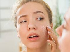 Skin Problem in Winter: ਸਰਦੀਆਂ 'ਚ ਅਕਸਰ ਹੋ ਜਾਂਦੀ Skin Problem! ਜਾਣੋ ਕੱਚੇ ਦੁੱਧ ਦਾ ਕਮਾਲ