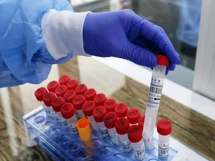 Omicron in India: Corona की स्पीड ने बढ़ाई टेंशन, 14 जिलों में 5-10% वीकली पॉजिटिविटी रेट, 33 दिन बाद 10 हजार से ज्यादा मामले Covid 19 omicron health ministry delhi maharashtra coronavirus cases positivity rates Omicron in India: Corona की स्पीड ने बढ़ाई टेंशन, 14 जिलों में 5-10% वीकली पॉजिटिविटी रेट, 33 दिन बाद 10 हजार से ज्यादा मामले