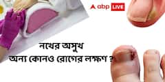 Nail Infection : নখ ভেঙে যাচ্ছে? পচে যাচ্ছে? অন্য কোনও রোগের লক্ষণ নয় তো?