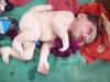 Unique Baby Gopalganj: गोपालगंज में चार पैर और तीन हाथ वाले बच्चे को देखकर डॉक्टर भी हैरान, एक लाख में आते हैं एक केस