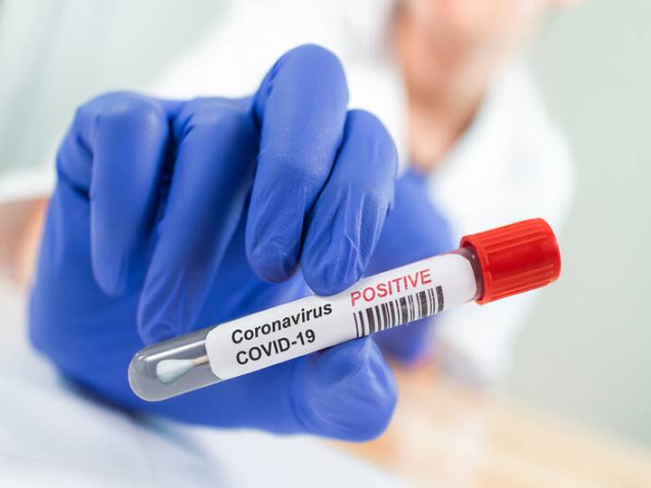Mathura Uttar Pradesh On Sunday 11 corona cases found on Saturday also 11 cases were found vaccine given Mathura News: मथुरा में कोरोना के 11 नए मरीज मिले, जानिए- इसे रोकने के लिए क्या किया जा रहा