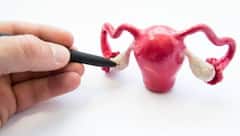 Ovarian Cancer: জরায়ুর ক্যান্সারের প্রাথমিক লক্ষণগুলি কী কী? নিরাময় সম্ভব?