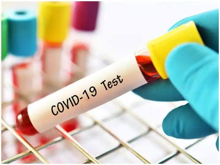 230 resident doctors at Mumbai hospitals test Covid-19 positive in 3 days Covid-19 : মুম্বইয়ের বিভিন্ন হাসপাতালেও করোনার থাবা, ৩ দিনে সংক্রমিত ২৩০ চিকিৎসক