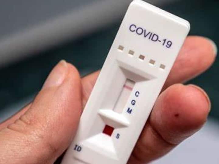 कोविड-19 रैपिड एंटीजन सेफ टेस्ट किट (Covid-19 Rapid Antigen Self Test Kit) : कोरोना से जंग के लिए यह इक्युपमेंट काफी कारगर है. इसकी मदद से आप घर बैठे खुद ही रैपिड एंटीजन टेस्ट कर सकते हैं. यह बाजार में 250 से 300 रुपये में उपलब्ध है.