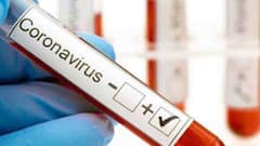 Corona: আক্রান্ত এটিকে মোহনবাগানের ফুটবলার, স্থগিত ওড়িশা এফসির বিরুদ্ধে ম্যাচ | Bangla News