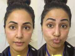 Hina Khan Photos: हिना खान की कैसी हो गई हालत! चेहरे पर पड़े निशान देख फैंस हुए परेशान, एक्ट्रेस बोलीं- परिवार में सब...