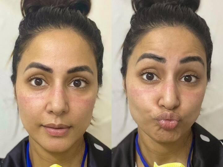 हिना खान (Hina Khan) ने नई तस्वीरें सोशल मीडिया पर शेयर की हैं. हिना खान का हाल देख उनके फैंस परेशान हो गए.