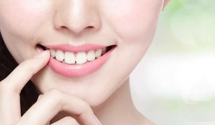 Follow these hacks to whiten yellow teeth and teeth whitening tips Teeth care tips: પીળા દાંતને સફેદ કરવા માટે  અપનાવો આ હૈક્સ, જાણો અસરકારક ટિપ્સ