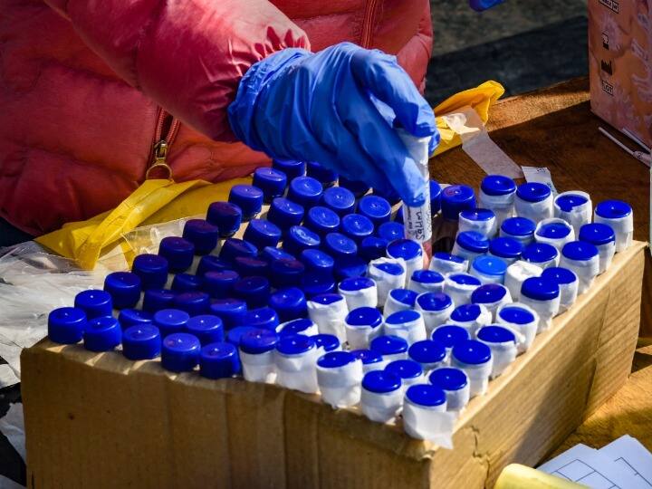 Corona Cases Increase again in Chandigarh tricity 48 percent surge in infections in a Last week Chandigarh Corona News: चंडीगढ़ में कोरोना के ग्राफ में उछाल, पिछले एक सप्ताह में संक्रमण में 48% की बढ़ोतरी