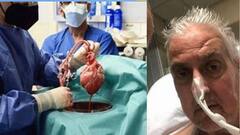 Medical Achievement: মানুষের শরীরে শূকরের হৃদপিণ্ড, চিকিত্‍সায় নতুন নজির আমেরিকায়| Bangla News