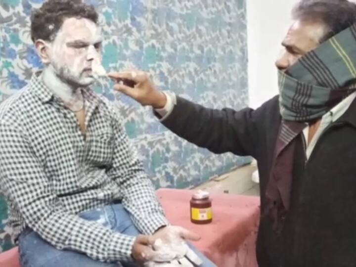 madhya pradesh vidisha man allegedly attacked by girl with acid as his face burnt ANN Vidisha Acid Attack: विदिशा में ट्रेन में सफर कर रहे शख्स पर लड़की ने फेंक दी तेजाब, बुरी तरह घायल