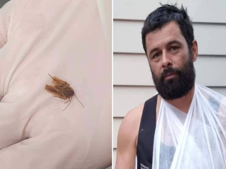 New Zealand man had cockroach living inside his ear and finally taken dead outside after 3 days Cockroach inside Man: ‘3 நாட்களாக காதுக்குள் ஏதோ நெளிகிறது’ - நியூசிலாந்து மனிதனுக்கு காத்திருந்த அதிர்ச்சி!