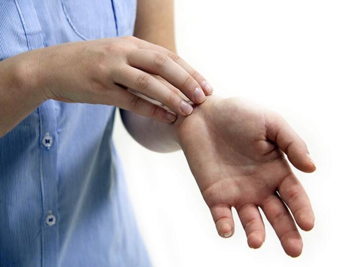 Omicron Symptoms: ओमिक्रोन की निशानी हो सकते हैं त्वचा पर दिखाई देने वाले ये लक्षण, नजरअंदाज करना पड़ सकता है भारी These symptoms visible on the skin can be a sign of Omicron, it can be heavy to ignore Omicron Symptoms: ओमिक्रोन की निशानी हो सकते हैं त्वचा पर दिखाई देने वाले ये लक्षण, नजरअंदाज करना पड़ सकता है भारी