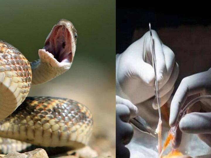 Pune: 30 year old patient recovers after complete shutdown of kidneys in rare snake bite Snake Bite: இது மெடிக்கல் மிராக்கிள்.. பாம்பு கடித்தும் இப்படி நடக்குமா? ஆச்சரியத்தில் மருத்துவர்கள்!!