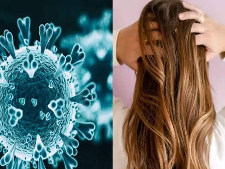 Feeling Hair Loss After Corona? Amla powder and coconut oil helps Covid HairLoss | கொரோனா பாதிப்புக்கு பிறகு கொத்துகொத்தாய் முடி உதிர்வா? இந்த இரண்டு பொருட்களை வாங்குங்க..