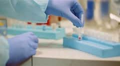 Corona: ‘পরিকল্পনা করে দ্রুত বাড়ানো হোক পরীক্ষা’, রাজ্যগুলিকে চিঠি কেন্দ্রীয় স্বাস্থ্যমন্ত্রকের অতিরিক্ত সচিবের| Bangla News