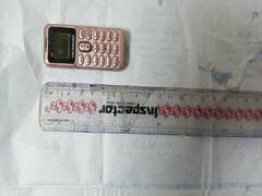 Delhi News: तिहाड़ जेल के कैदी के पेट से निकली ऐसी चीज़, जान कर उड़ जाएंगे आपके होश, अस्पताल में हुआ खुलासा