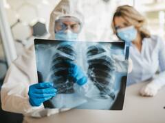 Scientists Develop Covid Test Using X-rays That Gives Result Within Minutes, Is 98% Accurate