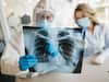 Scientists Develop Covid Test Using X-rays That Gives Result Within Minutes, Is 98% Accurate