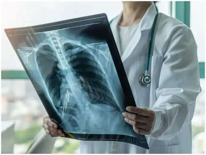 IIT Jodhpur Researchers developed artificial intelligence algorithm based method screening corona X-ray lungs ANN Covid Test: अब फेफड़े का एक्स-रे देखकर कोरोना वायरस का पता लगेगा, आईआईटी जोधपुर ने विकसित की ये नई तकनीक