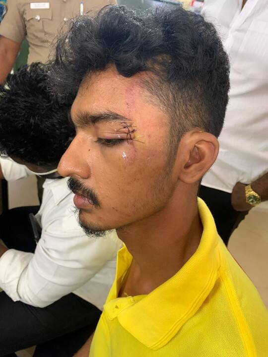 A case has been registered against 9 policemen in connection with the brutal attack on a law student near Otteri in Chennai சட்டக்கல்லூரி மாணவர் கொடூரமாக தாக்கப்பட்ட விவகாரத்தில் 9 போலீசார் மீது வழக்குப்பதிவு