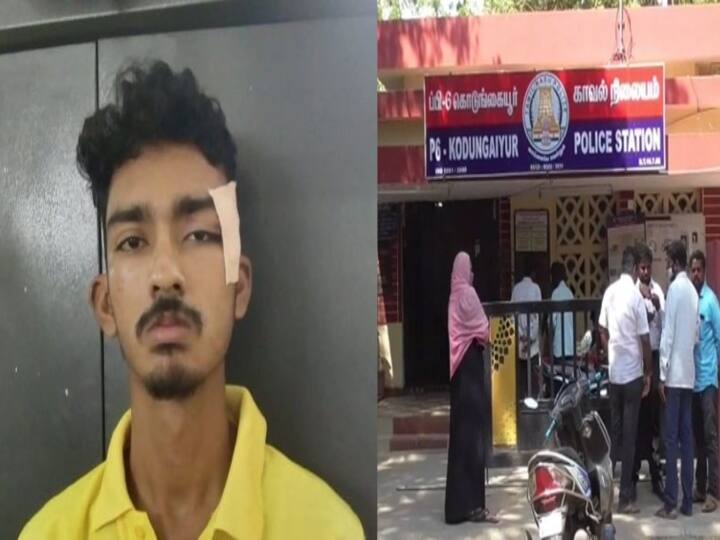 Chennai: Case registered Against 9 policein  Kodungaiyur Law student attack case Law Student Issue | கொடுங்கையூர் சட்டக்கல்லூரி மாணவர் தாக்கப்பட்ட விவகாரம்.. அதே காவல் நிலையத்தில் 9 போலீசார் மீது வழக்குப்பதிவு !