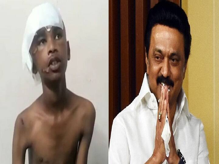 Tamil Nadu CM Plan save life of 13 year old boy injured in accident, Read Doctor Thanks Note Tamil Nadu CM Update:விபத்தில் அடிபட்ட சிறுவன்.. உயிரை காப்பாற்றிய முதல்வர் திட்டம்.. நெகிழ்ச்சியில் நன்றி கூறிய மருத்துவர்