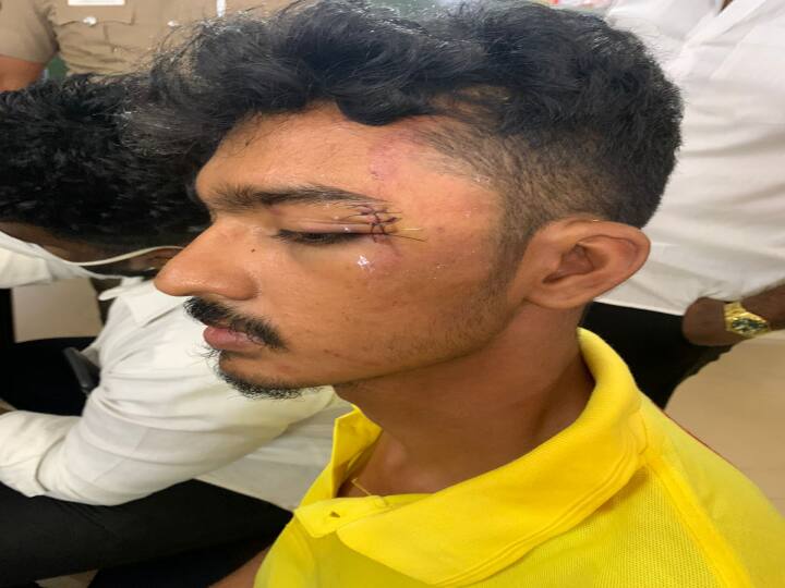 Interview with a law student who was stripped naked and victimised by kodungayur police Law Student Attacked | 