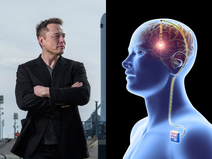 Elon Musk Brain Chip: इंसान की पुरानी यादों को अब नए शरीर में किया जा सकेगा ट्रांसफर! दिमाग में कंप्यूटर के जरिए लगाई जाएगी चिप