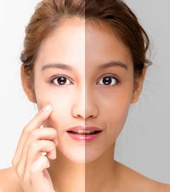 गर्मियों में सनबर्न से बचाएंगे ये आसान घरेलू उपाय, झुलसी हुई त्वचा भी चमकने लगेगी