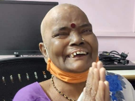 Satara  Malharpeth Andhashraddha Nirmulan Samiti help Sharda babar from clotted hair ...आणि शारदाताई खळखळून हसल्या !”