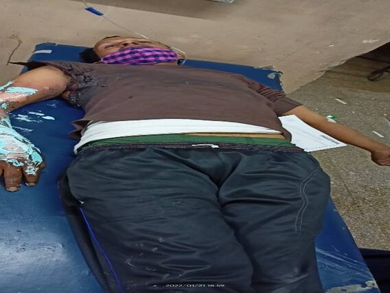 MP News: इंदौर में एक तरफा मोहब्बत में महबूबा के दर पर जल गया आशिक, हालत गंभीर, जानें पूरा मामला MP News: इंदौर में एक तरफा मोहब्बत में महबूबा के दर पर जल गया आशिक, हालत गंभीर, जानें पूरा मामला