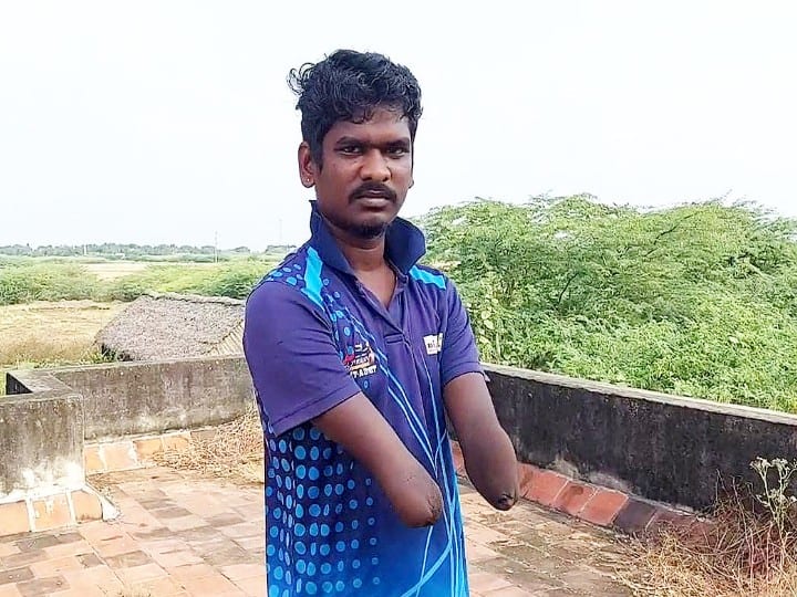 Ramanathapuram: Tragedy of losing limbs due to low voltage power line near Paramakudi due to ne மின்வாரியத்தின் அலட்சியத்தால் பரமக்குடி அருகே தாழ்வாக செல்லும் மின் கம்பியால் கை கால்களை இழக்கும் அவலம்