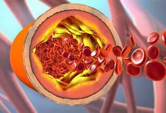 Health Tips:અનેક રોગોની દવા છે શેકલું લસણ, જાણો સેવનથી શું થાય છે ફાયદા