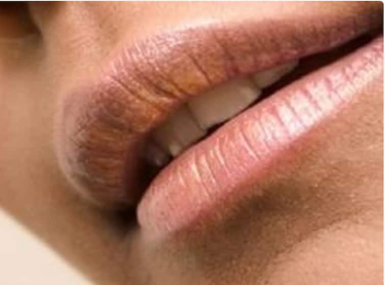 Health Update how-to-remove-lips-blackness ओठांना काळेपणा आलाय? असा दूर करा...