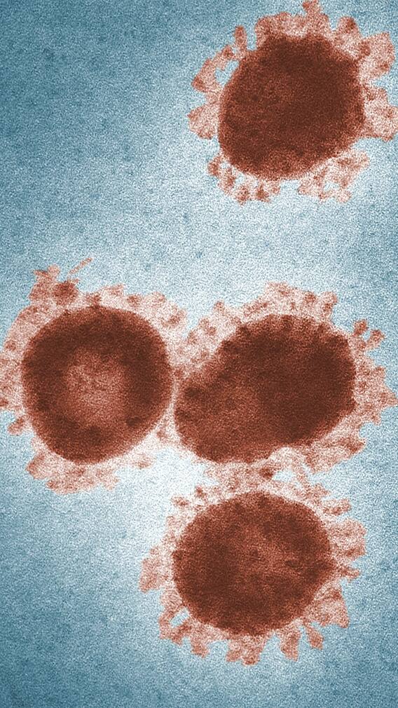 నియోకోవ్ ఎందుకంత డేంజర్?