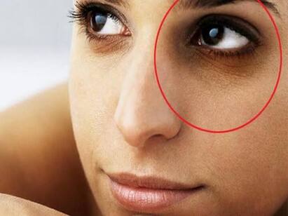 Skincare Tips: 5 Under Eye Care Protection Tips For Women Under Eye Care: கருவளையமா? கண்ணை சுற்றி பை போல வீக்கமா? உடனே இதை மட்டும் பண்ணுங்க..