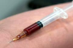 ਸ਼ਖਸ ਨੇ ਪ੍ਰਾਈਵੇਟ ਪਾਰਟ 'ਚ ਲਾਇਆ Cocaine ਦਾ ਟੀਕਾ, ਫਿਰ ਜੋ ਹੋਇਆ ਉਸ ਨੇ ਸਭ ਨੂੰ ਕਰ ਦਿੱਤਾ ਹੈਰਾਨ