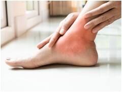 Control Uric Acid: यूरिक एसिड के मरीज इन बातों का रखें ध्यान, हमेशा कंट्रोल रहेगा यूरिक एसिड