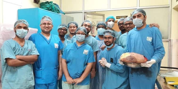 Calcutta Medical College and Hospital doctors successfully removes 10 kg tumour from a woman Kolkata News: বাস থেকে নামতে গিয়ে আঘাত, তা থেকে ১০ কেজির টিউমার, জটিল অস্ত্রোপচারে বার করা হল মহিলার শরীর থেকে