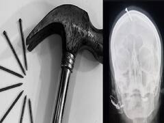 Crime | ஆண் குழந்தைக்காக கர்ப்பிணி தலையில் ஆணி அடித்த கொடூரம்.. அதிர்ந்துபோன டாக்டர்!