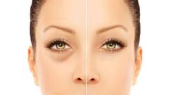 Eye Beauty Tips : સોજેલી આંખો આપના સૌદર્યમાં બને છે બાધક,  આ સરળ ઘરેલુ ઉપાયથી મેળવો  છૂટકારો