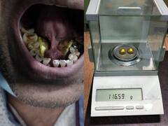 Jaipur News: इस शातिर तरीके से छुपाकर ला रहा सोना कि मशीन से नहीं चला पात, फिर ऐसे हुआ खुलासा