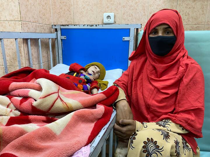 UNICEF Warns 1 Million Afghan Children May Die Due To Acute Malnutrition Without Immediate Action UNICEF Warns 1 Million Afghan Children May Die Due To Acute Malnutrition If No Immediate Action Is Taken
