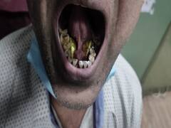 Rajasthan News: जीभ के नीचे लाखों रुपये का सोना छुपाकर दुबई से आया तस्कर, जयपुर एयरपोर्ट पर हुआ गिरफ्तार