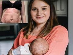 Rare Condition: కన్నబిడ్డను ముట్టుకుంటే అలెర్జీ, ఈ తల్లి పరిస్థితి ఎవరికీ రాకూడదు