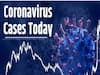 Corona Updates: తెలుగు రాష్ట్రాల్లో భారీగా తగ్గిన కరోనా కేసులు, ఏపీలో 434 , తెలంగాణలో 614 కోవిడ్ కేసులు 