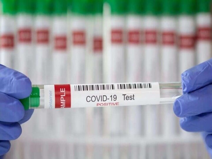 Turkey | மருத்துவமனை.. தனிமை... ரிப்பீட்டு... 441 நாட்களாக கொரோனா தொற்றால் அவதிபடும் துருக்கி நபர்...!